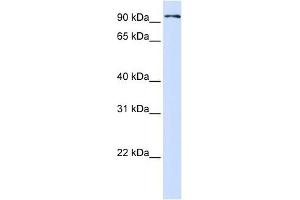 PCDHB13 antibody used at 1 ug/ml to detect target protein. (PCDHB13 anticorps  (Middle Region))