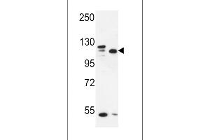 Western blot analysis in MDA-MB435,MCF-7 cell line lysates (35ug/lane). (SEC24C anticorps  (AA 443-470))