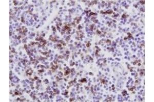 Immunohistochemistry (IHC) image for anti-CD8 (CD8) antibody (ABIN1449140) (CD8 anticorps)