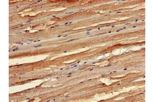 Immunohistochemistry of paraffin-embedded human skeletal muscle tissue using ABIN7168997 at dilution of 1:100