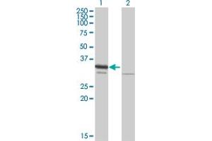 Western Blot analysis of RPA2 expression in transfected 293T cell line by RPA2 MaxPab polyclonal antibody. (RPA2 anticorps  (AA 1-270))