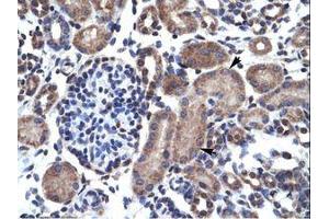 Image no. 1 for anti-B-Cell CLL/lymphoma 2 (BCL2) (AA 54-103) antibody (ABIN6735914)