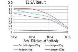 Black line: Control Antigen (100 ng),Purple line: Antigen (10 ng), Blue line: Antigen (50 ng), Red line:Antigen (100 ng)