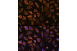Immunofluorescence analysis of L929 cells using SND1 Rabbit pAb (ABIN6129741, ABIN6148197, ABIN6148199 and ABIN6221577) at dilution of 1:100 (40x lens).