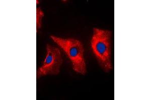Immunofluorescent analysis of Vimentin staining in MCF7 cells. (Vimentin anticorps  (C-Term))