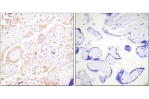 Immunohistochemistry analysis of paraffin-embedded human placenta tissue, using GATA3 (Ab-308) Antibody. (GATA3 anticorps  (AA 274-323))