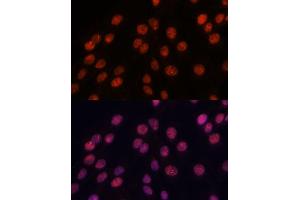 Immunofluorescence analysis of C6 cells using IPO8 antibody (ABIN7267859) at dilution of 1:100.