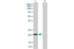Western Blot analysis of IFNA10 expression in transfected 293T cell line by IFNA10 MaxPab polyclonal antibody. (IFNA10 anticorps  (AA 1-189))
