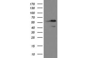 Image no. 3 for anti-Methionyl Aminopeptidase 2 (METAP2) (AA 2-212) antibody (ABIN1491153) (METAP2 anticorps  (AA 2-212))