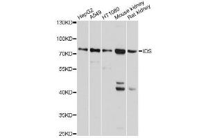 Western blot analysis of extracts of various cell lines, using IDS antibody. (IDS anticorps  (AA 34-290))