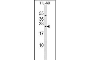 RPL10L Antibody (N-term) (ABIN1539610 and ABIN2849193) western blot analysis in HL-60 cell line lysates (35 μg/lane). (RPL10L anticorps  (N-Term))