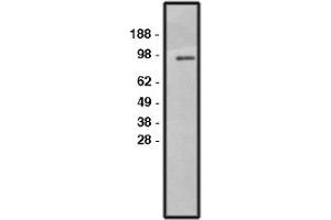 Image no. 1 for anti-Solute Carrier Family 9, Subfamily A (NHE1, Cation Proton Antiporter 1), Member 1 (SLC9A1) antibody (ABIN265248) (SLC9A1 anticorps)