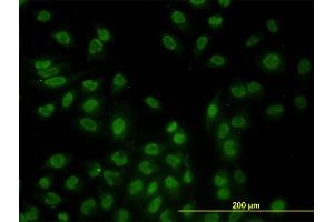 Immunofluorescence of monoclonal antibody to STK17B on HeLa cell. (DRAK2 anticorps  (AA 272-372))