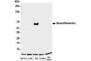 Western Blotting (WB) image for anti-Neurofilament, Light Polypeptide (NEFL) (AA 150-200) antibody (ABIN7453980)