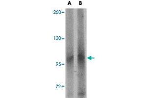 Western blot analysis of LRFN1 in human brain tissue lysate with LRFN1 polyclonal antibody  at (A) 1 and (B) 2 ug/mL . (LRFN1 anticorps  (C-Term))