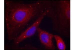 Image no. 3 for anti-P21-Activated Kinase 1 (PAK1) (pThr212) antibody (ABIN196879) (PAK1 anticorps  (pThr212))
