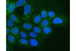 IF analysis of Integrin alpha 3/ITGA3 using anti-Integrin alpha 3/ITGA3 antibody (ABIN7602696).