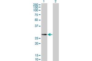 Western Blot analysis of SLA2 expression in transfected 293T cell line by SLA2 monoclonal antibody (M01), clone 3G5. (SLAP2 anticorps  (AA 1-261))