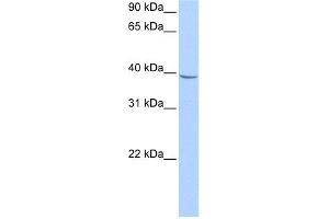 WB Suggested Anti-NUDT17 Antibody Titration:  0. (NUDT17 anticorps  (Middle Region))