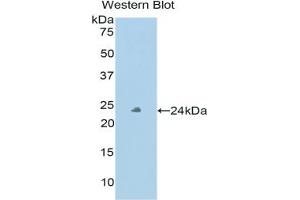 Western blot analysis of the recombinant protein. (Peroxidasin anticorps  (AA 76-260))