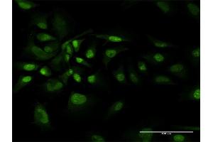 Immunofluorescence of purified MaxPab antibody to BAG1 on HeLa cell. (BAG1 anticorps  (AA 1-274))