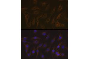 Immunofluorescence analysis of C6 cells using EB3/M Rabbit mAb (ABIN7268535) at dilution of 1:100 (40x lens). (MAPRE3 anticorps)