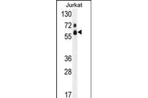 Western blot analysis of hFASTK- (ABIN391120 and ABIN2841247) in Jurkat cell line lysates (35 μg/lane). (FASTK anticorps  (C-Term))