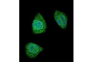 Confocal immunofluorescent analysis of PDGFB Antibody (C-term) (ABIN388460 and ABIN2848858) with 293 cell followed by Alexa Fluor 488-conjugated goat anti-rabbit lgG (green). (PDGFB anticorps  (C-Term))