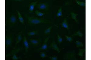 Image no. 3 for anti-Aldehyde Dehydrogenase 1 Family, Member L1 (ALDH1L1) antibody (ABIN1496581) (ALDH1L1 anticorps)
