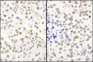 Immunohistochemistry (IHC) image for anti-Protein Quaking (QKI) (C-Term), (Isoform 5) antibody (ABIN7454593) (QKI anticorps  (C-Term, Isoform 5))
