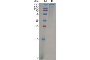 Human CD205 Protein, His Tag on SDS-PAGE under reducing condition.