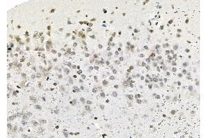ABIN6263687 and ABIN6279632 at 1/100 staining Rat brain tissue by IHC-P. (NOL7 anticorps  (C-Term))