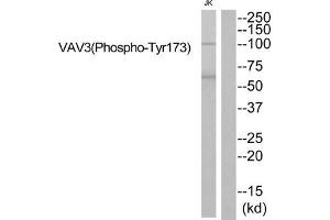 Western blot analysis of extracts from JK cells using VAV3 (Phospho-Tyr173) Antibody. (VAV3 anticorps  (pTyr173))