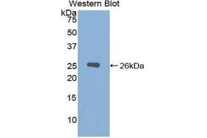 Western Blotting (WB) image for anti-Chordin (CHRD) (AA 422-635) antibody (ABIN1858405) (Chordin anticorps  (AA 422-635))