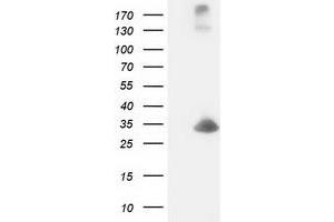 Western Blotting (WB) image for anti-Deoxycytidine Kinase (DCK) antibody (ABIN1497773) (DCK anticorps)