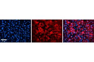 Rabbit Anti-EIF4G2 Antibody   Formalin Fixed Paraffin Embedded Tissue: Human Liver Tissue Observed Staining: Cytoplasm in hepatocytes Primary Antibody Concentration: N/A Other Working Concentrations: 1:600 Secondary Antibody: Donkey anti-Rabbit-Cy3 Secondary Antibody Concentration: 1:200 Magnification: 20X Exposure Time: 0.