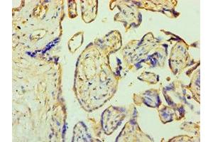 Immunohistochemistry of paraffin-embedded human placenta tissue using ABIN7176253 at dilution of 1:100