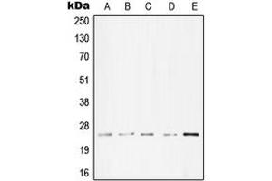 Western blot analysis of cTnI expression in A431 (A), Molt4 (B), A549 (C), NIH3T3 (D), PC12 (E) whole cell lysates. (TNNI3 anticorps  (Center))