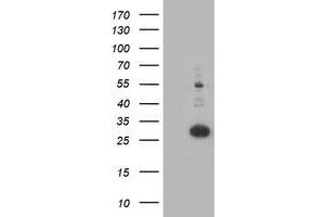 Western Blotting (WB) image for anti-Pyridoxamine 5'-Phosphate Oxidase (PNPO) antibody (ABIN1500319)