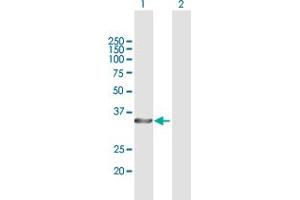 Western Blot analysis of STUB1 expression in transfected 293T cell line by STUB1 MaxPab polyclonal antibody. (STUB1 anticorps  (AA 1-303))