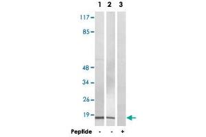 Western blot analysis of extracts from COLO 205 cells (Lane 1 and lane 3) and HeLa cells (Lane 2), using BRP44L polyclonal antibody . (BRP44L anticorps  (Internal Region))