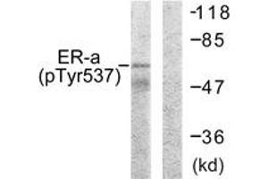 Western blot analysis of extracts from 293 cells, using Estrogen Receptor-alpha (Phospho-Tyr537) Antibody. (Estrogen Receptor alpha anticorps  (pTyr537))