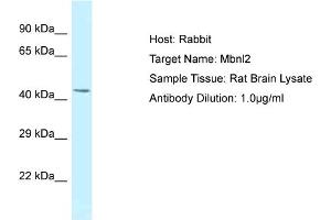 Host: Rabbit Target Name: MBNL2 Sample Tissue: Rat Brain Antibody Dilution: 1ug/ml (MBNL2 anticorps  (Middle Region))