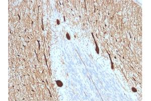 Formalin-fixed, paraffin-embedded human Cerebellum stained with CA8 Mouse Monoclonal Antibody (CPTC-CA8-2). (CA8 anticorps)