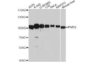 Western blot analysis of extracts of various cell lines, using PARG antibody. (PARG anticorps  (AA 777-976))