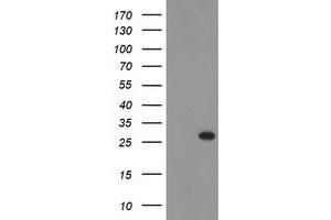 Image no. 2 for anti-THAP Domain Containing 6 (THAP6) antibody (ABIN1501374)