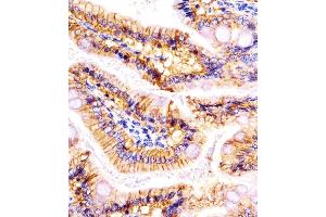 (ABIN6242231 and ABIN6578095) staining (Mouse) Epcam in mouse colon sections by Immunohistochemistry (IHC-P - paraformaldehyde-fixed, paraffin-embedded sections).
