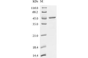 (Tris-Glycine gel) Discontinuous SDS-PAGE (reduced) with 5 % enrichment gel and 15 % separation gel.