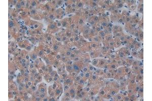 Detection of PKR in Human Liver Tissue using Polyclonal Antibody to Protein Kinase R (PKR)