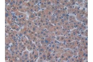 Detection of PKR in Human Liver Tissue using Polyclonal Antibody to Protein Kinase R (PKR) (EIF2AK2 anticorps  (AA 224-502))